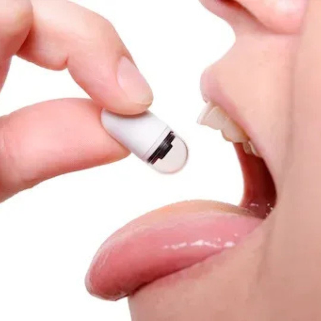 Capsule Endoscopy - PillCam