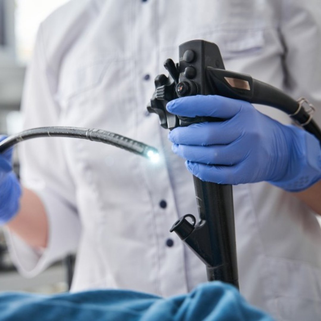 Endoscopic Retrograde Cholangiopancreatography (ERCP)