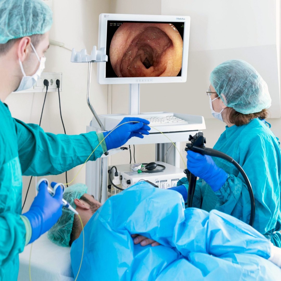Upper Endoscopy